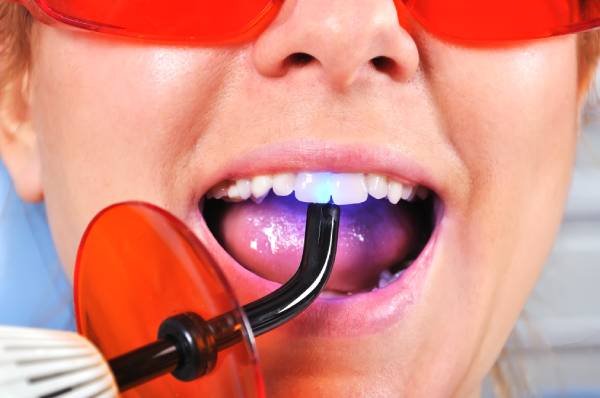 Why Your Tooth Filling Fell Out What To Do Next